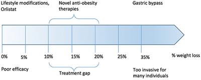 No Guts, No Loss: Toward the Ideal Treatment for Obesity in the Twenty-First Century